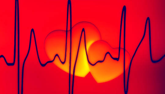 Raise the Bar on Love and Let Love Be Joyful Raise the Bar on Love and Let Love Be Joyful