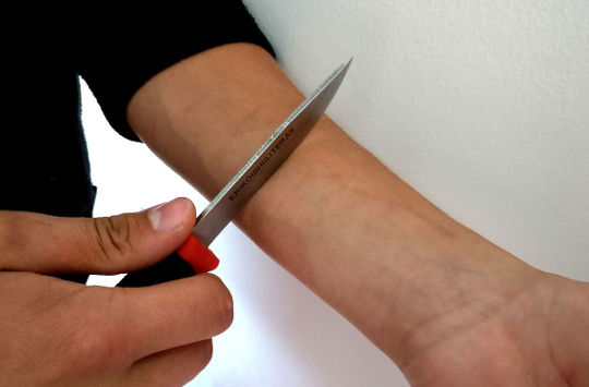 Why Do People Intentionally Injure Themselves? Why Do People Intentionally Injure Themselves?