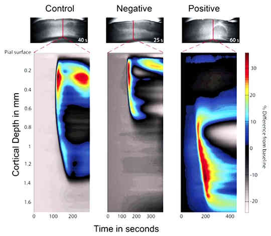 the optical images shows the wave of spreading depolarization in the brain the optical images shows the wave of spreading depolarization in the brain