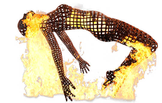 What Works For Me: 1, 2, 3... TENS What Works For Me: 1, 2, 3... TENS