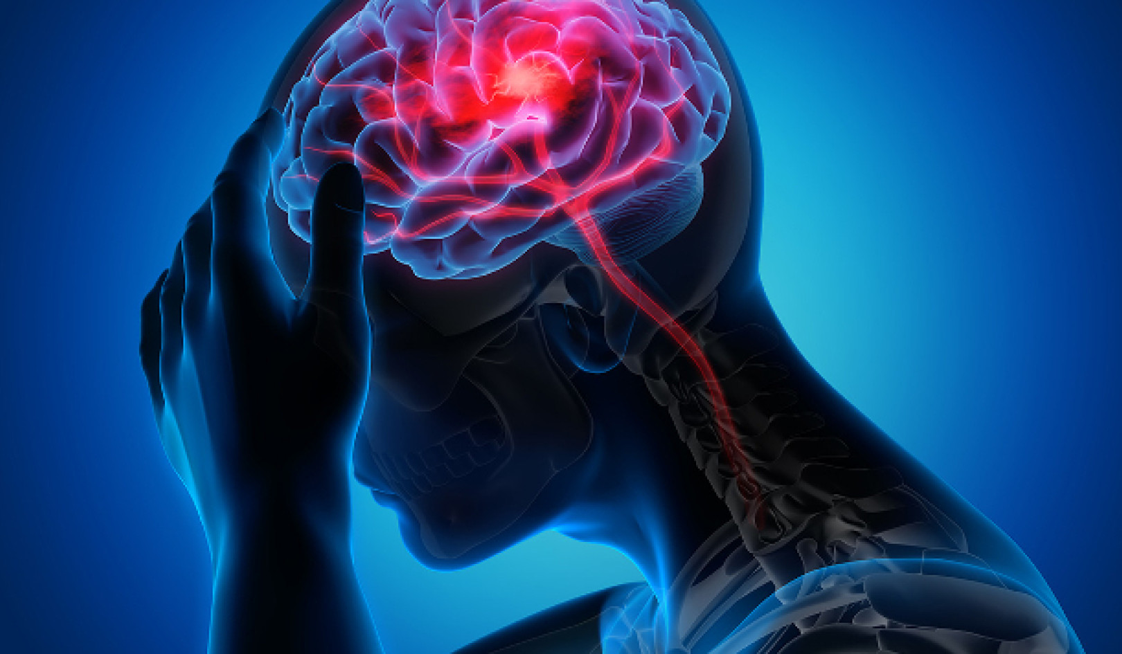 Spot A Stroke And Act Fast